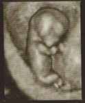 3D-1 (12 Weeks)