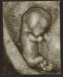 3D-2 (12 Weeks)