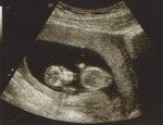 US-1 (12 Weeks)