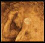 Madison Elizabeth 20 Weeks