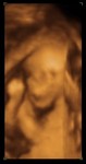 Madison Elizabeth 20 Weeks