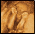 Madison Elizabeth 20 Weeks