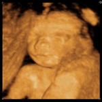 Madison Elizabeth 20 Weeks