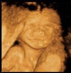 Highlight for Album: 20 Weeks