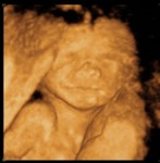 Madison Elizabeth 20 Weeks