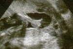 ThumbsUp-20Weeks